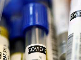 Russia records 17,378 COVID-19 cases in past 24 hours - Response Center